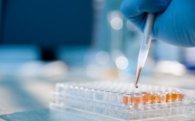 Lab technician injecting liquid into a microtiter plate